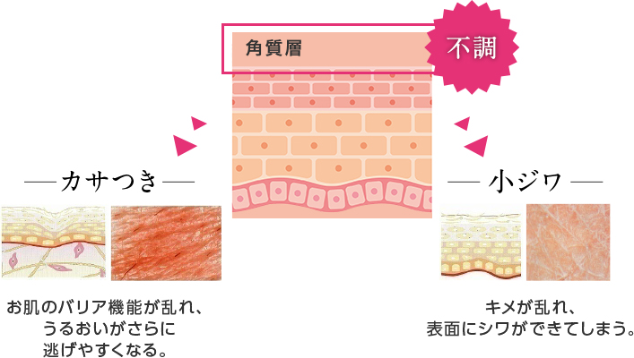 不調の肌イメージ図