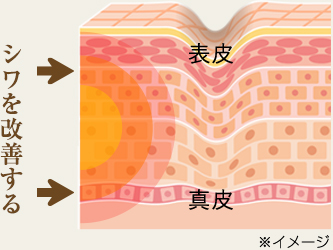 Wrinkle Lift Cream リンクルリフトクリーム